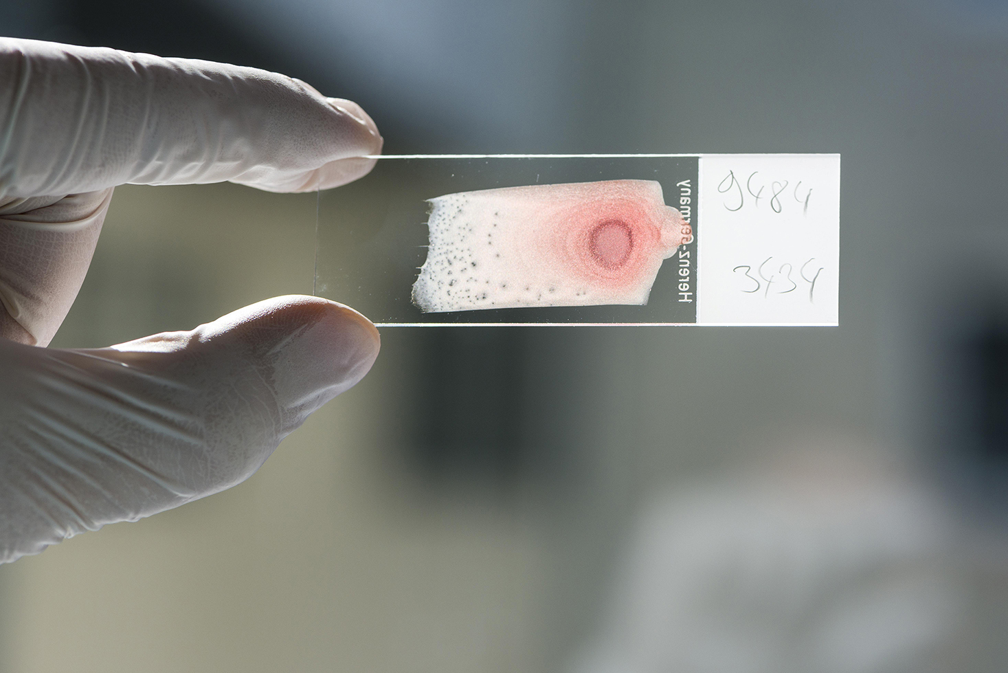 Исследование пятен спермы на одежде в лаборатории