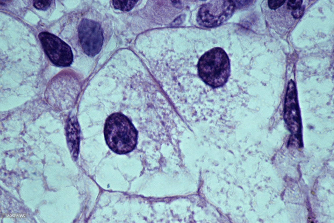 Митохондрии в клетках печени. Хондриосомы в клетках печени амфибии. Клетка хондриосомы в клетках печени амфибии. Митохондрии в клетках печени под микроскопом. Клетки печени под микроскопом.