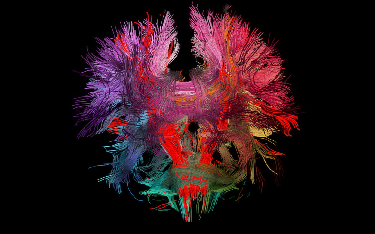 Коннектом книга. Коннектом мозга. Трактография мрт. Коннектом мозга человека это. The 2nd law.