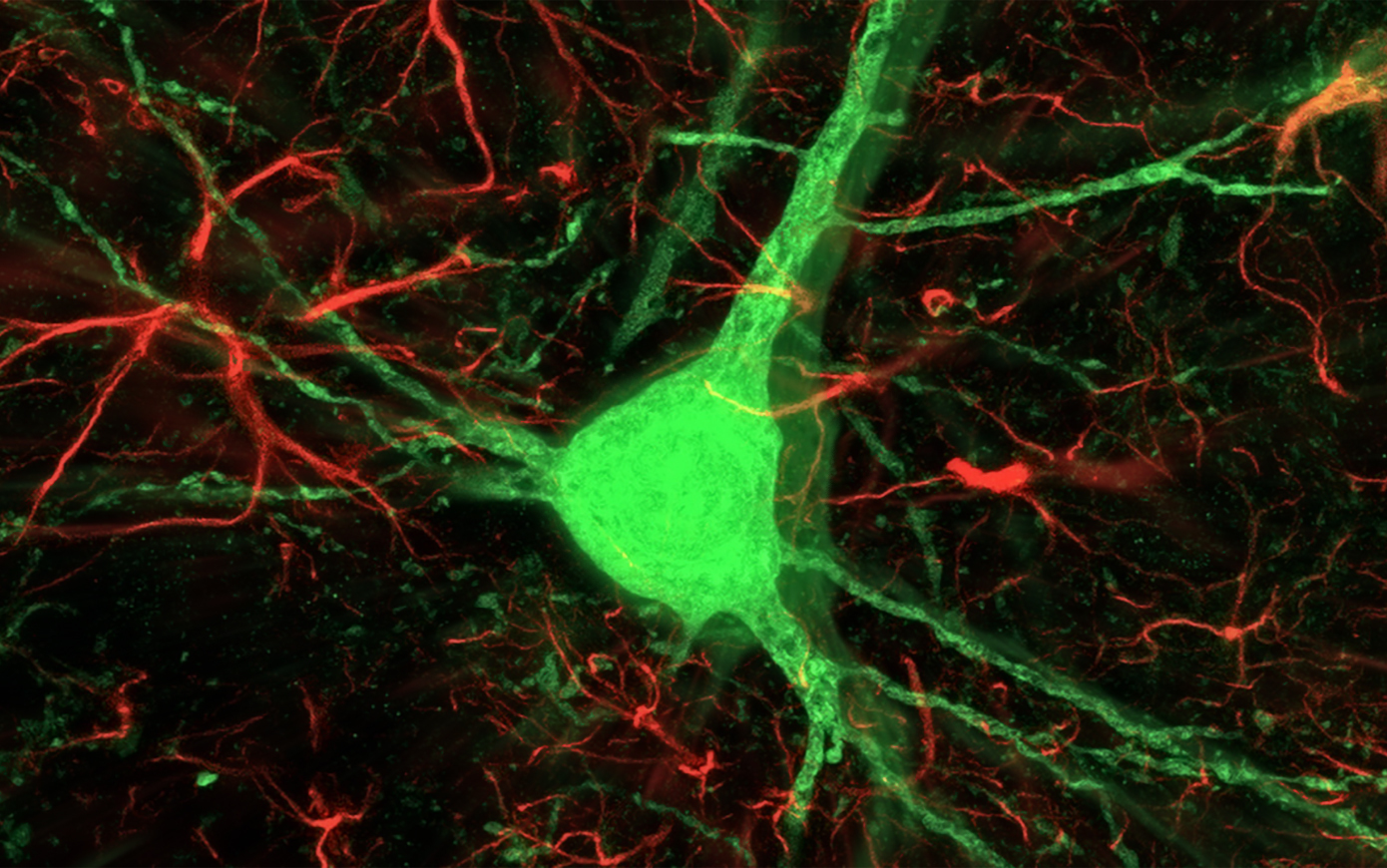 Новые клетки мозга. Нейроны. Нейроны головного мозга. Рост нейронов. Рост нервных клеток.