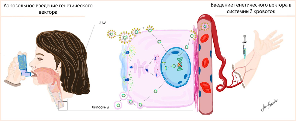 Рис. 3. Принципиальные подходы в генной терапии муковисцидоза: для перемещения терапевтического гена в клетку возможно использовать различные способы доставки (векторы), например: аденоассоциированный вирус (AAV) и липосомы (“пузырьки” из клеточных мембран). После проникновения в клетку, терапевтический ген достигает ядра клетки, где с помощью него сначала образуются информационные посредники – иРНК, а затем с их инструкций синтезируется белок, который в последующем модифицируется и встраивается в клетку для выполнения функции хлоридного канала