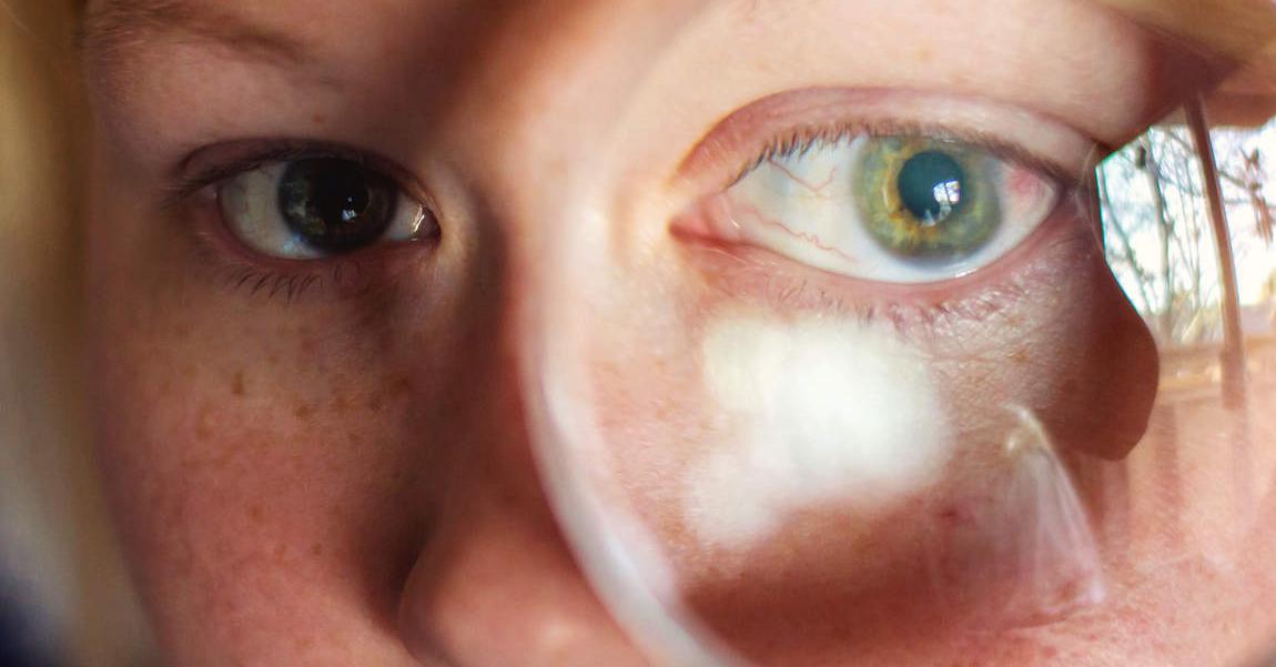 Синдром сухого глаза лечение тауфоном thumbnail
