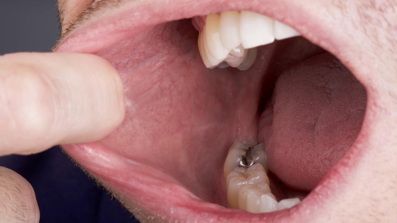 Повреждения полости рта и губ: что порекомендовать покупателю? | Щотижневик АПТЕКА