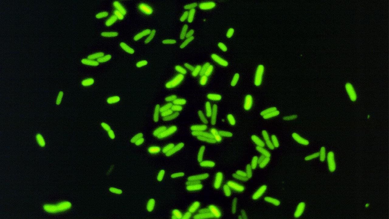 Светящиеся бактерии. Биолюминесценция, светящиеся бактерии. Флуоресцентная микроскопия escherichia coli. Светящиеся бактерии. Флуоресцентные бактерии.