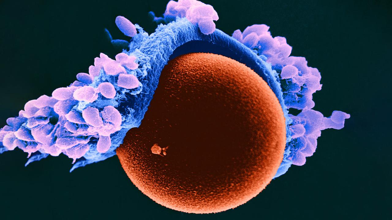 Яйцеклетка фото под микроскопом как выглядит