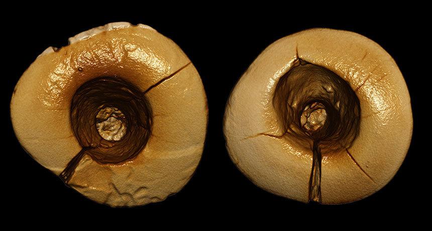 Как лечили зубы в древности