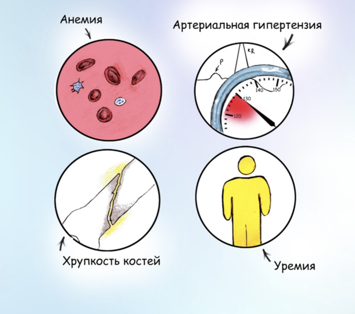 «12 месяцев».Поликистоз почек. Часть первая: потеря ориентации и перевоплощение тканей