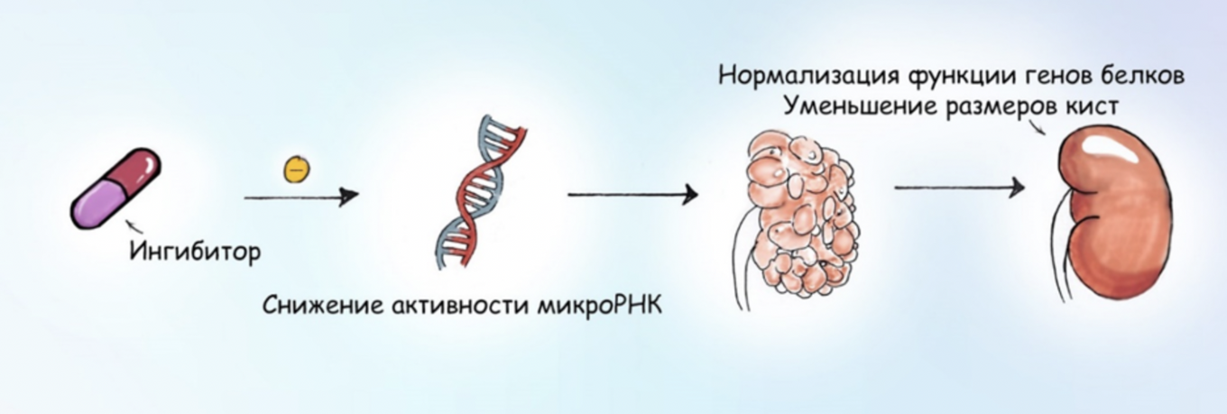 «12 месяцев».Поликистоз почек. Часть первая: потеря ориентации и перевоплощение тканей