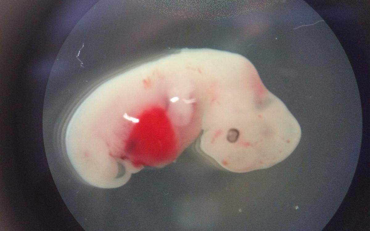 Как Выглядит Эмбрион Фото