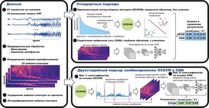 Двухкомпонентный компьютерный алгоритм с высокой точностью выявит эпилепсию