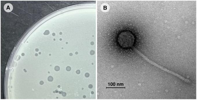 А — лабораторная культура бактерии Mycobacterium smegmatis, пораженная микобактериофагом Vic9. B — электронная микрофотография микобактериофага Vic9.