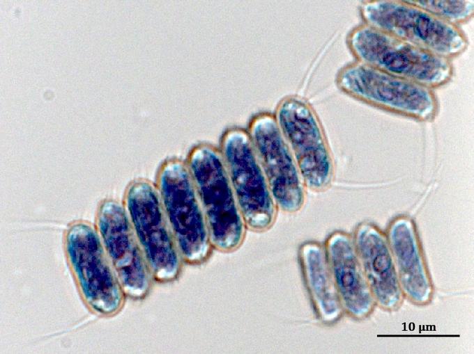 . Клетки Desmodesmus armatus ARC-06, окрашенные раствором Люголя. Крахмал окрашивается в сине-фиолетовый цвет