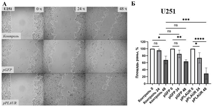 Миграция клеток глиомы U251 до и после активации гена PLAUR