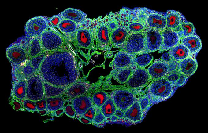 Яичник препубертатной (молодой) мыши. Яйцеклетки растущих фолликулов окрашены в ярко-красный цвет антителами против серотонина