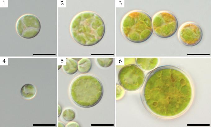 Световые микрофотографии Bracteacoccus minor: молодая клетка MZ–Ch31 (1), зрелая клетка MZ–Ch31 (2), зрелая клетка с оранжевыми каплями масла MZ–Ch31 (3), молодая клетка MZ–Ch39 (4), зрелая клетка MZ–Ch39 (5), зрелая клетка с желто-оранжевыми каплями масла MZ–Ch39 (6). Масштабная линейка 10 мкм.