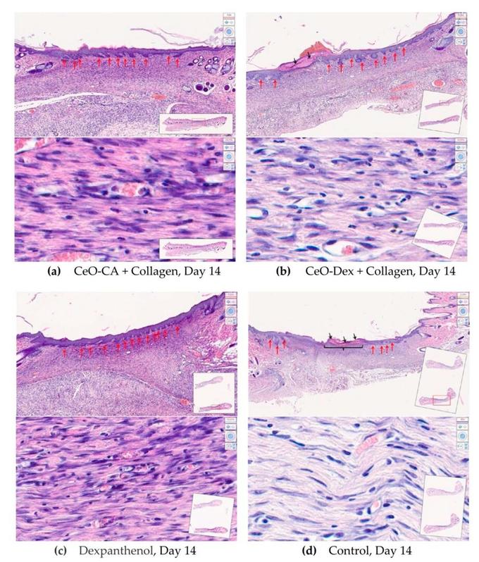 Срез тканей на месте ран на 14 сутки: (a, b) после обработки гелем, (с) после обработки декспантенолом, (d) в ходе самостоятельного заживления