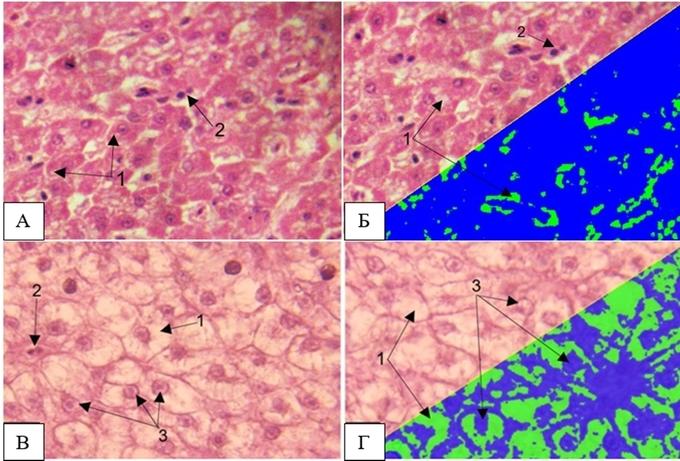 Микрофотографии ткани печени. (A,B) — здоровая рыба, (C,D) — рыба из Ладожского озера. 1 — Вакуолизация цитоплазмы гепатоцитов. 2 — Двуядерные клетки. 3 — Смещение ядер к периферии гепатоцитов.