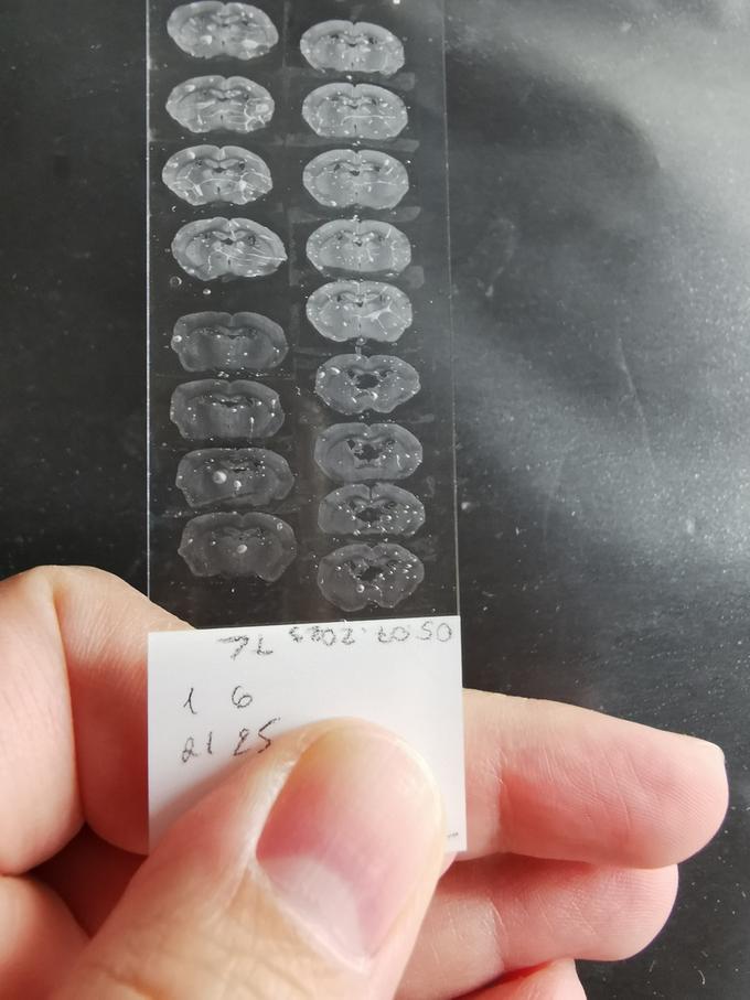 Срезы мышиного мозга на предметном стекле для иммуногистохимического окрашивания