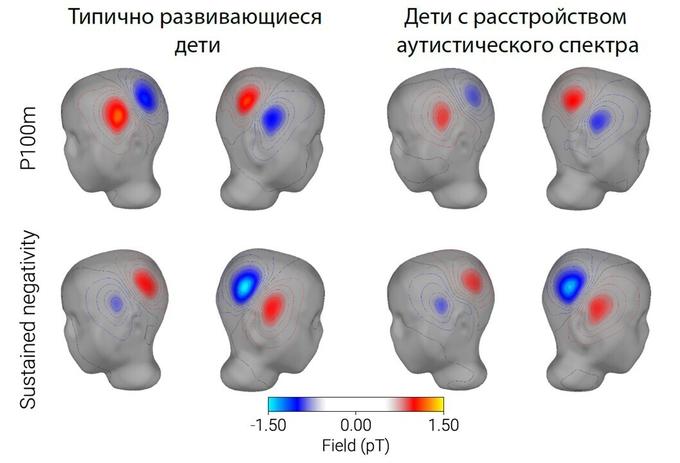 Магнитные поля, отражающие активность слуховой коры во время проведения эксперимента у здоровых детей и с расстройствами аутистического спектра