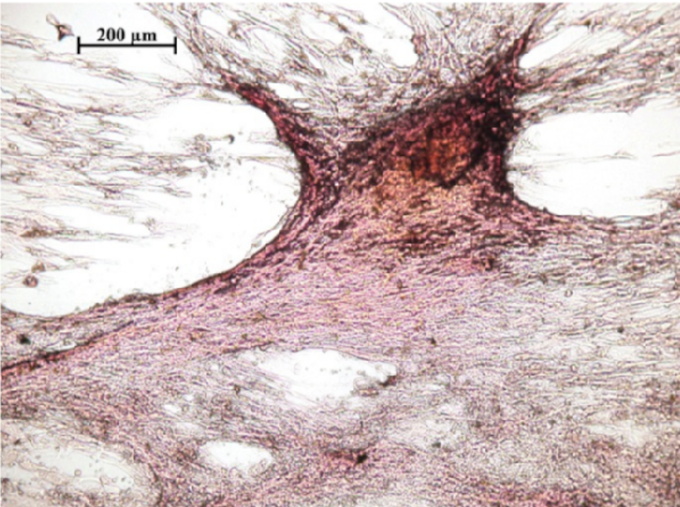Остеогенная дифференцировка стволовых клеток in vitro через 21 день культивирования в среде с добавлением хелидоната кальция.