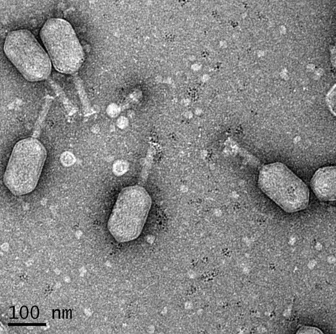 Вирусологи модифицировали бактериофаги для лечения рака